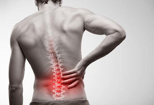 कमर दर्द (Lower Back Pain) के उपचार में कारगर एक्सरसाइज- डॉ आर के मुदगिल